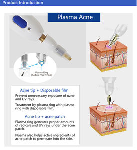 Pluma Multi-Plasma para el Cuidado de los Poros de Uso Doméstico para Lifting Facial y Tratamiento Fraccional de la Piel, Eliminación de Puntos Negros, Fácil de Guardar - Product Image 5