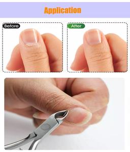 Meilleur emballage personnalisé vente en gros de pinces à cuticules en acier inoxydable pour ongles incarnés coupe-ongles tranchants Instruments chirurgicaux - Product Image 2