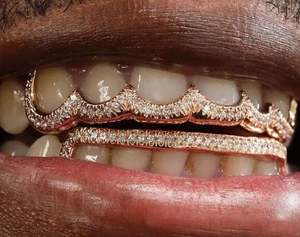 14-Piece 8X8 Custom Gold Grillz Set 10K 14K High End Luxury Quality Solid Edges CZ Tips Hip-Hop Style <b>Silver</b> Yellow White Rose - Product Image 3