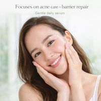 Sérum réparateur de l'acné et de la barrière cutanée avec acide salicylique et niacinamide pour resserrer les pores, infusé aux herbes, 30 ml liquide