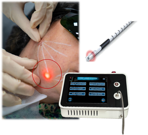 Endolaser portátil 980nm 1470nm lipólisis diodo láser máquina fibra óptica IPosucción para adelgazar estiramiento facial - Product Image 1