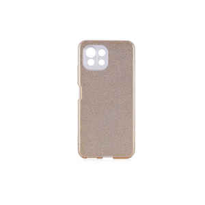 Funda de Silicona Brillante Dorada de Lujo MSRA para Xiaomi Mi 11 Lite, Cubierta Trasera de TPU Suave, Protección Antigolpes para Teléfono - Product Image 1