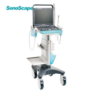 Ecógrafo Doppler Color Digital Portátil y Duradero SonoScape S8 ExpV con una Sonda S8 Exp para Clínica Veterinaria y Hospital - Product Image 1