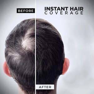 Fibra Capilar para Transformar el Cabello Fino y Delgado con Fibra Capilar Voluminizadora para Mujeres y Hombres - Product Image 6