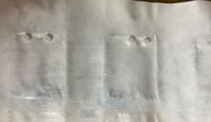 Kara Mediclust Anneaux tubaires laparoscopiques Anneaux de Fallope Forceps instruments chirurgicaux équipement médical - Product Image 2