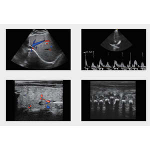 Equipo Médico de Ultrasonido 4D/5D, Escáner de Ultrasonido, Instrumento de Diagnóstico por Ultrasonido a Color de Alta Definición - Product Image 6