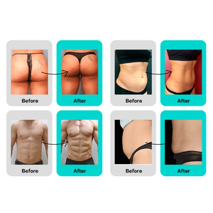 Máquina Profissional EMSzero com 4 Manípulos, Estimulador Muscular Eletrônico de Alta Intensidade Hi-EMT, Máquina de Construção Muscular EMS - Product Image 5