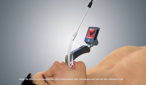 Çin ucuz ISO onaylı yeniden kullanılabilir video laringoskop rekabetçi fiyat ile videolaringoskop - Product Image 3