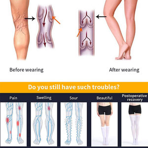 <span class=keywords><strong>Medias</strong></span> de compresión médicas personalizadas, antiembolismo, <span class=keywords><strong>para</strong></span> <span class=keywords><strong>prevenir</strong></span> venas varicosas - Product Image 5