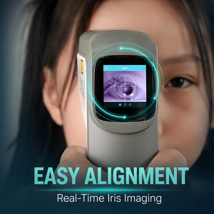 Refractómetro Automático Portátil <span class=keywords><strong>para</strong></span> Pruebas de Visión Rápidas <span class=keywords><strong>y</strong></span> Exámenes Oculares - Product Image 1