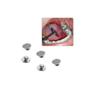 Botones Lenguales Manuales de Acero y Metal - Product Image 1