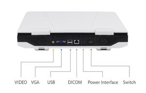 Nuevo Equipo de Ultrasonido Portátil Mindray DP-20 DP-30 DP-50 en Blanco y Negro, Sistema de Imágenes Ultrasónicas Digitales para Humanos - Product Image 2