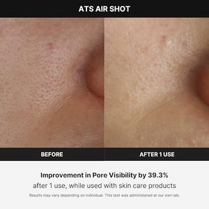 Para MEDICUBE Age-R ATS Air Shot 75g recién llegado instrumento de belleza coreano para Estiramiento facial al por mayor hecho en Corea - Product Image 3