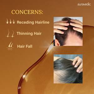 น้ำมันบำรุงผมโรสแมรี่วีแกน สมุนไพรบำรุงเส้นผม - Product Image 4