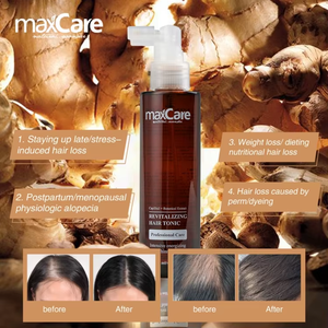 الأكثر مبيعًا زيت ماكسيكير لنمو الشعر العضوي إكسير علاج فروة الرأس الطبيعي لمكافحة تساقط الشعر منشط نمو الشعر 2 في 1 OEM للشعر - Product Image 2