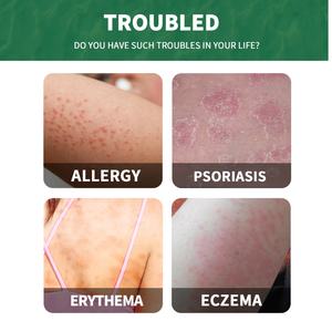 Crème anti-<span class=keywords><strong>d</strong></span>émangeaisons <span class=keywords><strong>pour</strong></span> les soins de santé, crème <span class=keywords><strong>pour</strong></span> la peau atteinte du <span class=keywords><strong>psoriasis</strong></span>, soins personnels, crème anti-inflammatoire, élimine les rougeurs, les gonflements, crème apaisante - Product Image 5