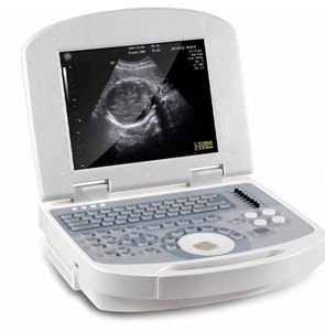 Pemindai <span class=keywords><strong>Ultrasound</strong></span> terapeutik dokter hewan portabel untuk pencitraan diagnostik medis untuk Klinik dokter hewan - Product Image 5