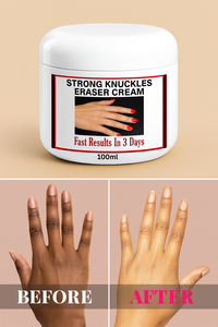Crème éclaircissante pour les genoux, les coudes et les doigts foncés, 100 ml, action rapide - Product Image 6