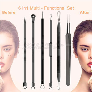 Kit de Extracción de Puntos Negros SAAR GLOBAL SURGICAL, Duradero y de Primera Calidad, SGS-903, Herramientas de Precisión de Acero Inoxidable para el Rostro, Agarre Cómodo - Product Image 6