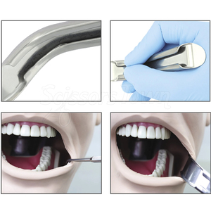 Retractor Bucal Dental de Alta Calidad, Instrumento de Acero Inoxidable para Abrir y Retraer la Boca en Procedimientos Dentales - Product Image 6