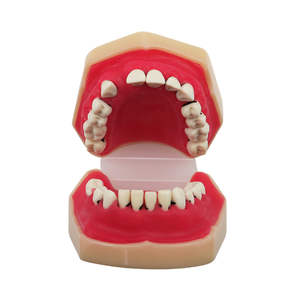 Modelo Educativo de Enseñanza Dental, Modelo de Enfermedad Periodontal - Product Image 5