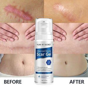 Gel de silicone pour cicatrices sous marque privée, gel cicatrisant OEM, traitement des vergetures, soin des cicatrices d'acné pour peaux sensibles - Product Image 1