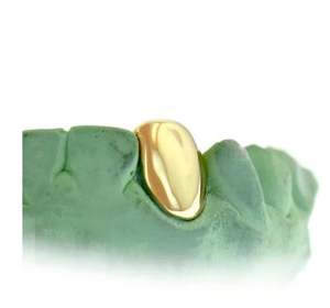 Ajuste personalizado grillz 2 dientes con colmillos de Grillz de ópalo blanco/925 Silver Slugs Grillz - Product Image 3