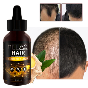 Huile capillaire végétalienne biologique en gros pour renforcer les cheveux, nourrir le cuir chevelu, favoriser la croissance et la réparation des cheveux, et prévenir la chute des cheveux - Product Image 5