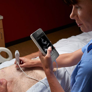 เครื่องอัลตราซาวนด์ GE Vscan Extend Dual Probe มือสอง พร้อมแบตเตอรี่ในตัว รองรับ OEM/ODM ปรับแต่งได้ มีตัวเลือกสำหรับการส่งออก - Product Image 2