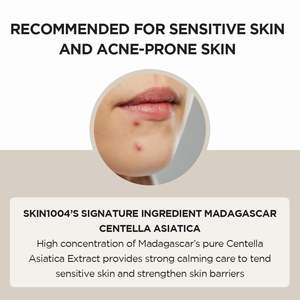 Korean Wholesale Bottle Packaging <b>Skin</b> <b>Care</b> Set Madagascar Centella Asiatica Ampoule Facial <b>Serum</b> 3.38 Fl.oz(100ml) - Product Image 3