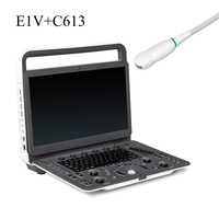 Ecógrafo Veterinario Portátil SonoScape E1V, Sistema en Blanco y Negro con Sonda Microconvexa C613 para Clínica de Animales Pequeños