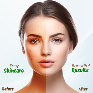 Argile de Nisha Multani pour le visage 100g, poudre d'argile de Fuller, contrôle naturel de l'huile, élimination de l'acné et du bronzage, masque facial pour tous types de peau - Product Image 5