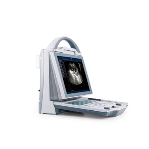 Rumah Sakit Digital Penuh Medis Portabel Oftalmik A/B Pemindai Ultrasound Terbaru A/B Scan Portabel Optical Ultrasound MSLPU23