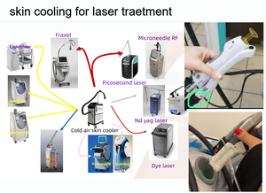 เครื่องทำความเย็นซิมเมอร์ -30 องศาเซลเซียส บรรเทาอาการปวดด้วยลมเย็น สำหรับการรักษาด้วยเลเซอร์ - Product Image 4