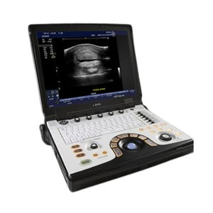 Appareil d'échographie GE LOGIQ E R8 d'occasion, OEM ODM personnalisable, imagerie 2D pour applications cardiaques et vasculaires - Product Image 3