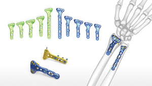 <span class=keywords><strong>Set</strong></span> plat tulang baja tahan karat implan ortopedi hewan kecil untuk produk dokter hewan Basis daya Manual operasi - Product Image 2