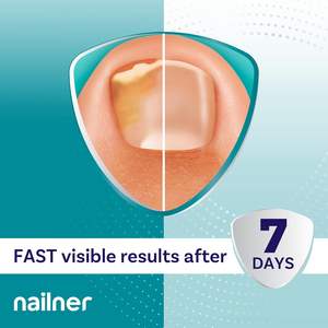 Nailner - Pluma de Tratamiento Antifúngico para Uñas de 4 ml, Solución Extra Fuerte para Infecciones Fúngicas de las Uñas de los Pies, Suministros para Uñas - Product Image 4
