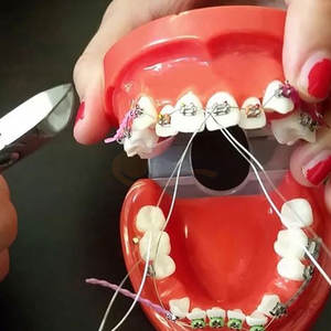 Nouveau Coupe-fil dentaire de qualité supérieure en acier inoxydable pour chirurgie abdominale complète, manuel, CE, pour appendicectomie - Product Image 3