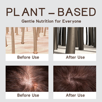 Complément Herbal 100% Naturel Personnalisable Anti-Chute de Cheveux, Le Plus Puissant pour la Croissance Capillaire, Équilibre le Sébum et Débouche les Follicules