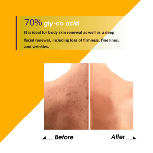Gel exfoliant à l'acide glycolique 70 AHA 30 ml, sérum anti-rides - Product Image 3