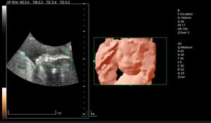Venta caliente Hospital carro móvil con ultrasonido Doppler color + convexo MSLCU46 - Product Image 5