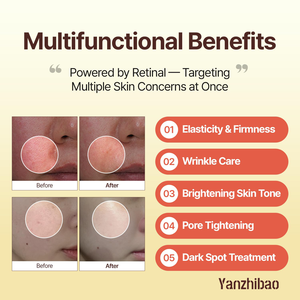 OEM Retinal <span class=keywords><strong>Booster</strong></span> <span class=keywords><strong>Serum</strong></span> 5,07 oz apunta a tono desigual, líneas finas y reparación de piel sensible - Product Image 3