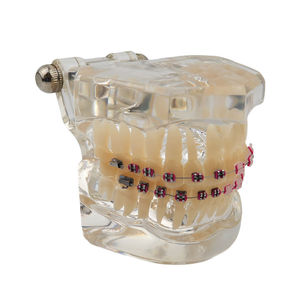 Brackets Metálicos y de Cerámica para Ortodoncia Dental, Brackets Autoligables para Aparatos Ortodóncicos - Product Image 4