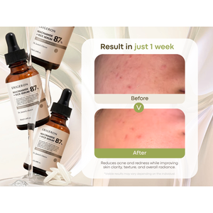 เซรั่มบำรุงผิวหน้า ERIGERON Radiant Glass Skin Effect สูตรสารสกัดจากข้าว ช่วยปรับสีผิวให้สม่ำเสมอ มีจำหน่ายราคาส่ง - Product Image 2