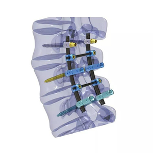 Juego de instrumentos ortopédicos para implantes vertebrales de uñas intramedulares, instrumentos quirúrgicos, manual de acero hecho en Pakistán - Product Image 5