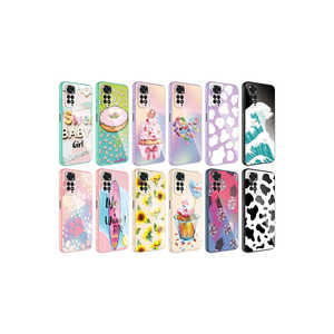 Coque de téléphone portable en silicone dur époxy à motif de protection de l'appareil photo pour Xiaomi Redmi Note 11S Global, anti-traces de doigts, électroplaquée - Product Image 3