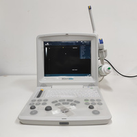 Sistema de Ultrasonido Portátil Veterinario en Blanco y Negro Edan DUS60 VET para Clínicas Veterinarias e Imágenes de Diagnóstico