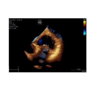 Appareil d'échographie GE Vivid E95 d'occasion - Product Image 6