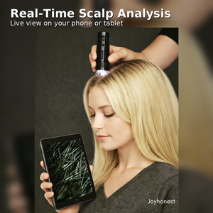 <span class=keywords><strong>Microscope</strong></span> capillaire et du cuir chevelu WiFi direct, caméra trichoscope pour l'analyse du cuir chevelu en salon, <span class=keywords><strong>microscope</strong></span> capillaire pour follicules pileux, caméra du cuir chevelu - Product Image 2