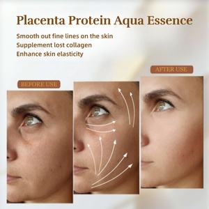 Biểu Tượng Tùy Chỉnh Nhau Thai Bản Chất Kit Nước Chống Lão Hó<span class=keywords><strong>a</strong></span> Chống-Nhăn Khô Sáng Dòng Làm Săn Chắc Tự Nhiên Sáng - Product Image 4